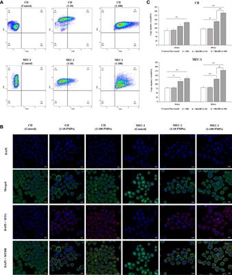 Platelet-derived microparticles provoke chronic lymphocytic leukemia malignancy through metabolic reprogramming